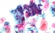 Deciphering a smear for cervical cytology